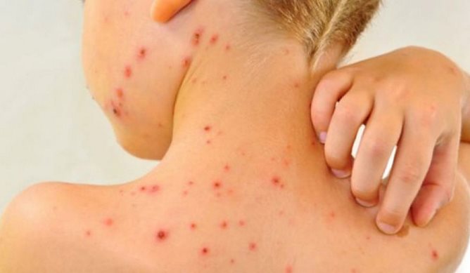 CREATOR: gd-jpeg v1.0 (using IJG JPEG v62), quality = 85