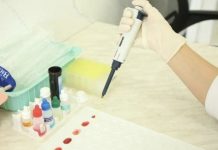 Жұмыс орындарында химиялық уланудың алдын алу шаралары